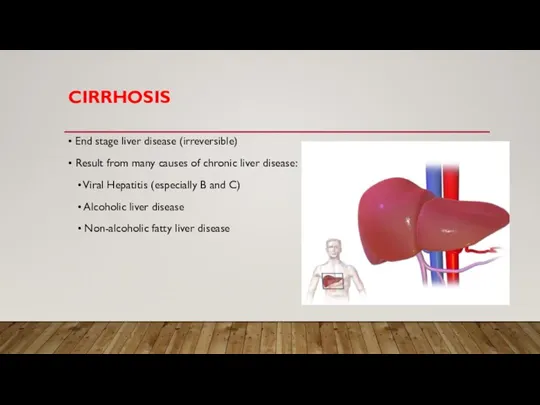 CIRRHOSIS • End stage liver disease (irreversible) • Result from many causes