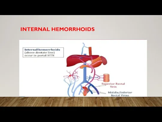 INTERNAL HEMORRHOIDS