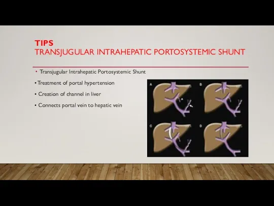 TIPS TRANSJUGULAR INTRAHEPATIC PORTOSYSTEMIC SHUNT Transjugular Intrahepatic Portosystemic Shunt • Treatment of