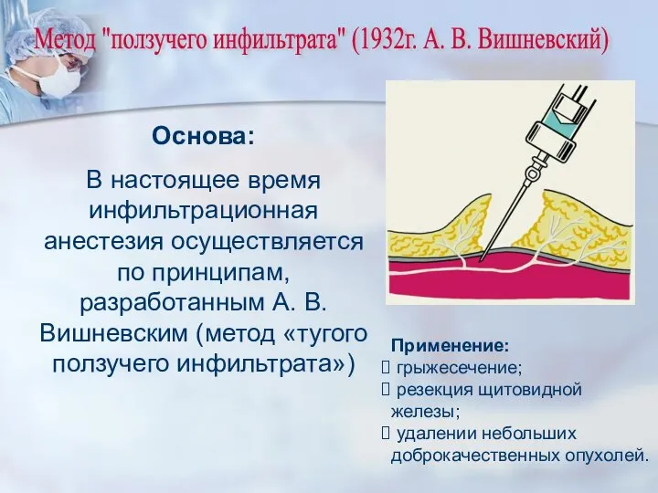 Метод "ползучего инфильтрата" (1932г. А. В. Вишневский) Основа: В настоящее время инфильтрационная