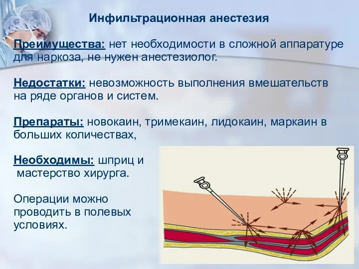 Инфильтрационная анестезия Преимущества: нет необходимости в сложной аппаратуре для наркоза, не нужен