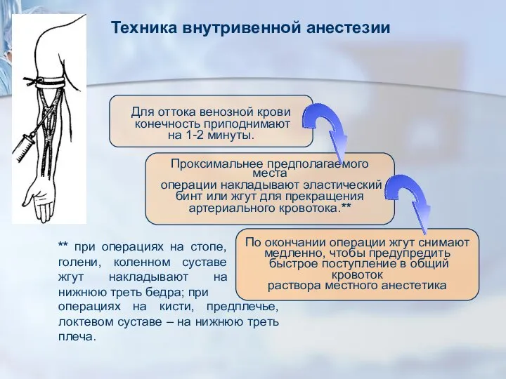 Техника внутривенной анестезии