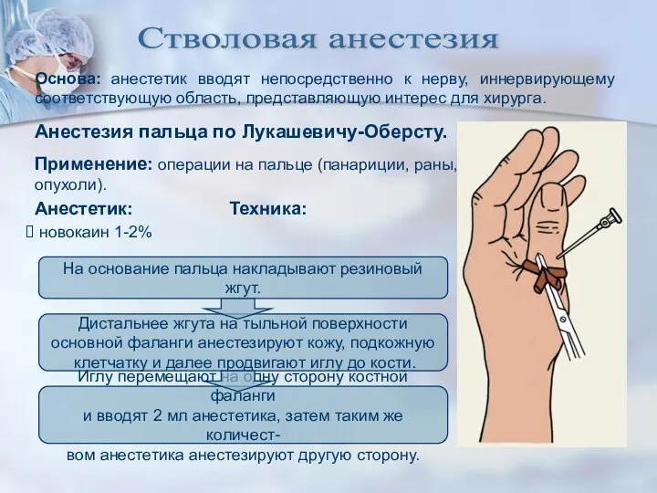 Стволовая анестезия Основа: анестетик вводят непосредственно к нерву, иннервирующему соответствующую область, представляющую