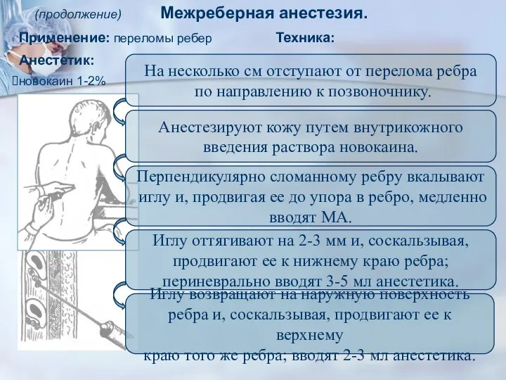 (продолжение) Межреберная анестезия.