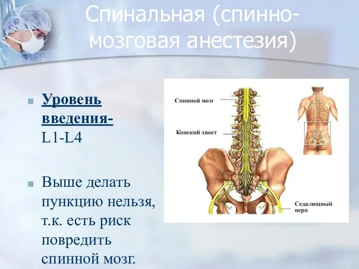 Спинальная (спинно-мозговая анестезия) Уровень введения- L1-L4 Выше делать пункцию нельзя, т.к. есть риск повредить спинной мозг.