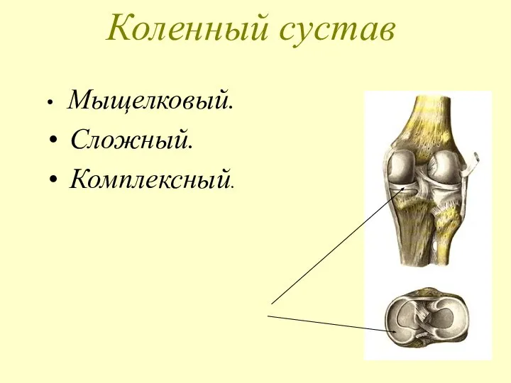 Коленный сустав Мыщелковый. Сложный. Комплексный.