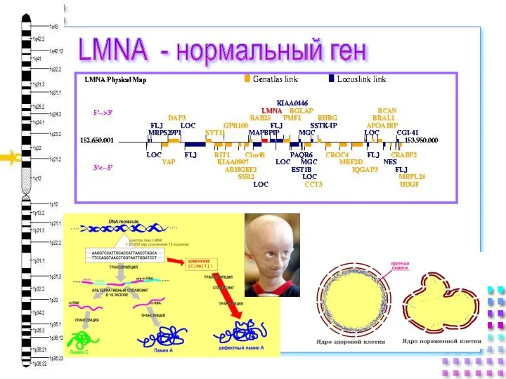 LMNA - нормальный ген