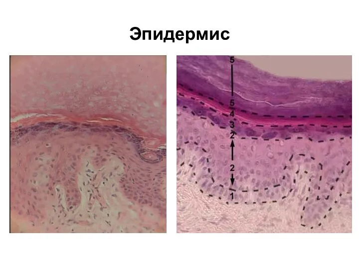 Эпидермис