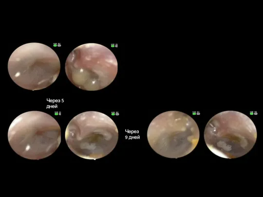 Через 5 дней Через 9 дней