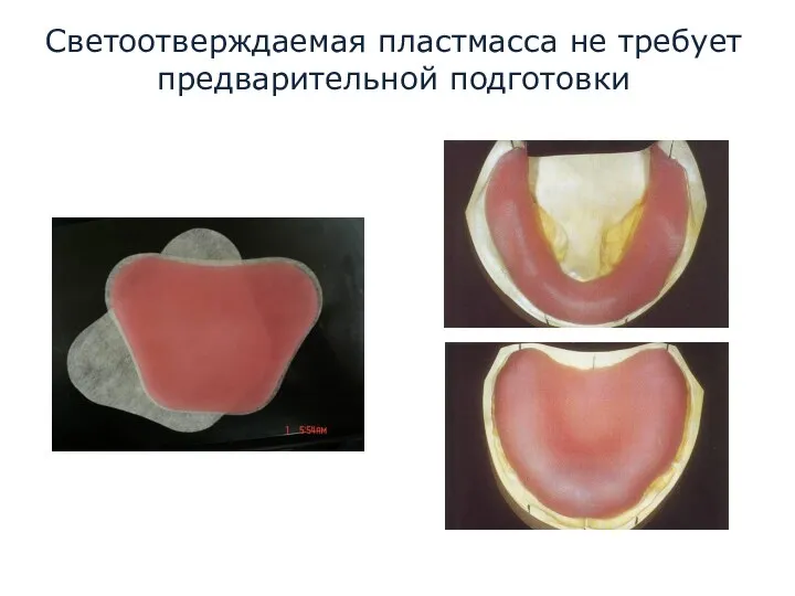 Светоотверждаемая пластмасса не требует предварительной подготовки