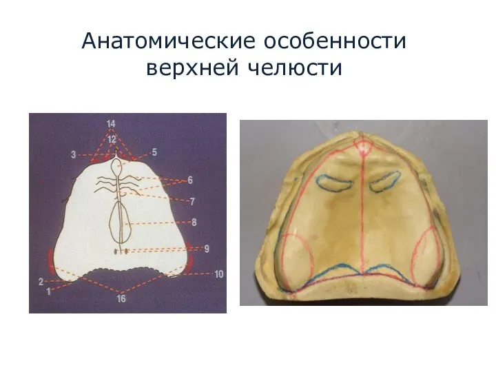 Анатомические особенности верхней челюсти