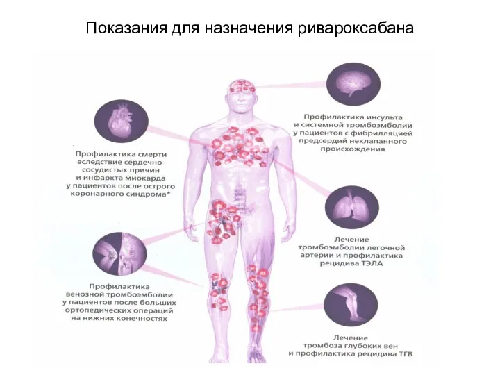 Показания для назначения ривароксабана