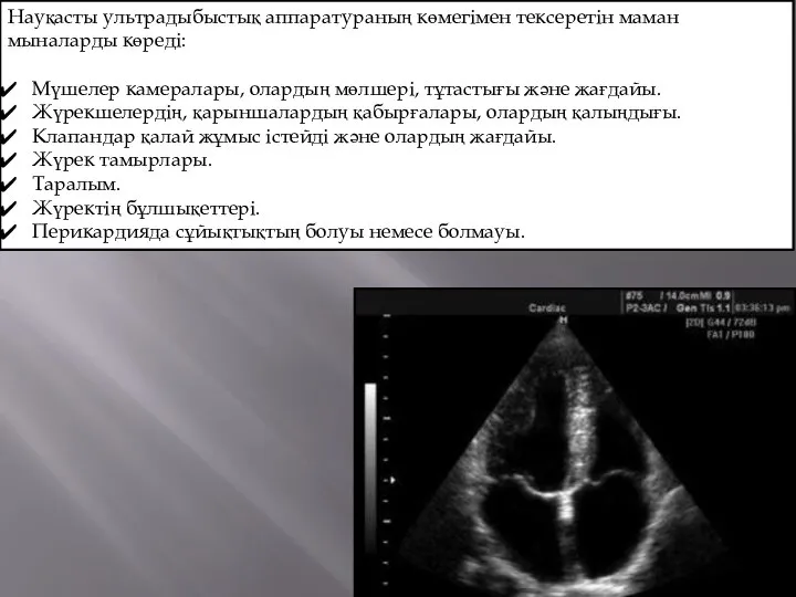 Науқасты ультрадыбыстық аппаратураның көмегімен тексеретін маман мыналарды көреді: Мүшелер камералары, олардың мөлшері,