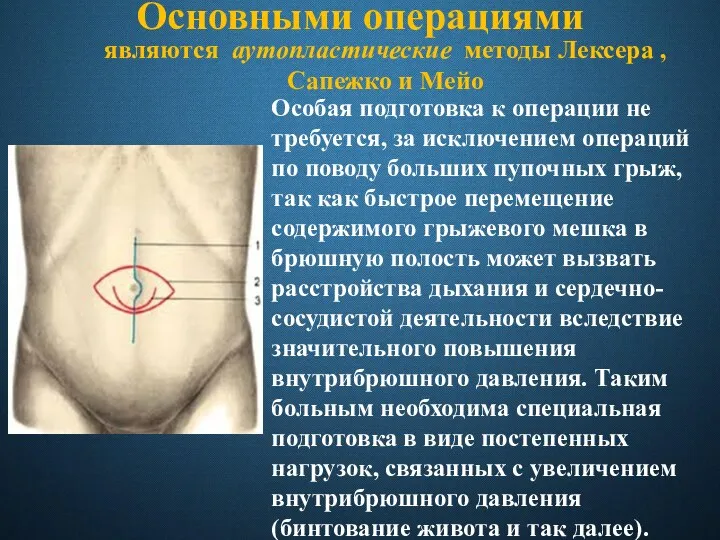 Основными операциями Особая подготовка к операции не требуется, за исключением операций по