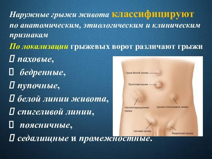 Наружные грыжи живота классифицируют по анатомическим, этиологическим и клиническим признакам По локализации