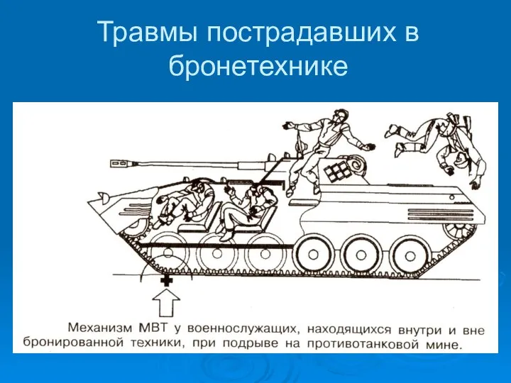 Травмы пострадавших в бронетехнике