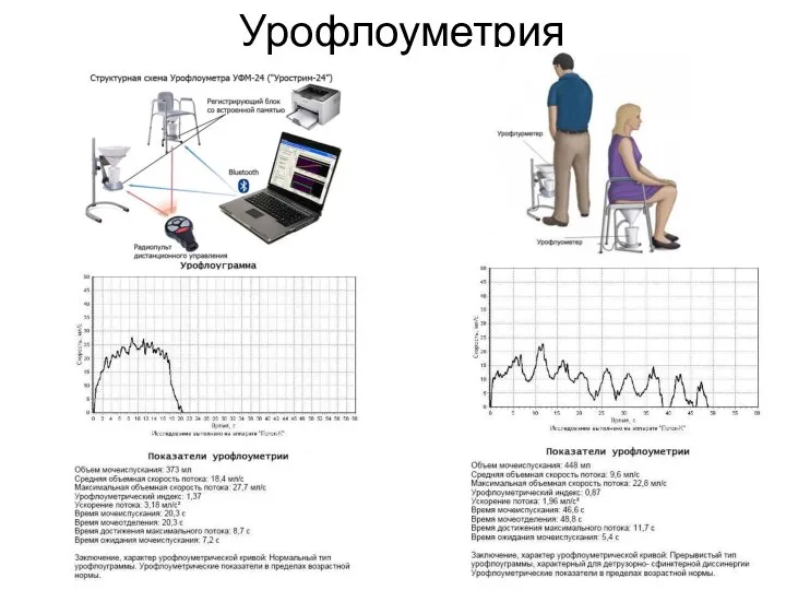 Урофлоуметрия