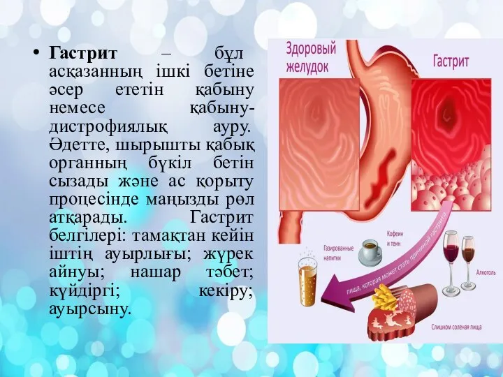 Гастрит – бұл асқазанның ішкі бетіне әсер ететін қабыну немесе қабыну-дистрофиялық ауру.