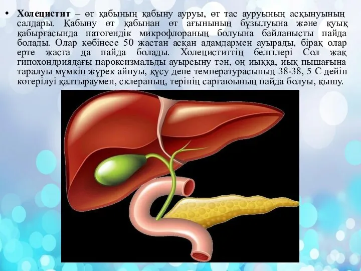 Холецистит – өт қабының қабыну ауруы, өт тас ауруының асқынуының салдары. Қабыну