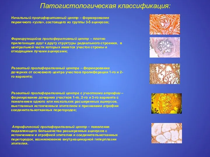 Начальный пролиферативный центр – формирование первичного «узла», состоящего из группы 3-5 ацинусов;