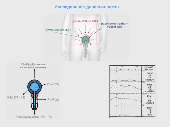 Исследование давление-поток.