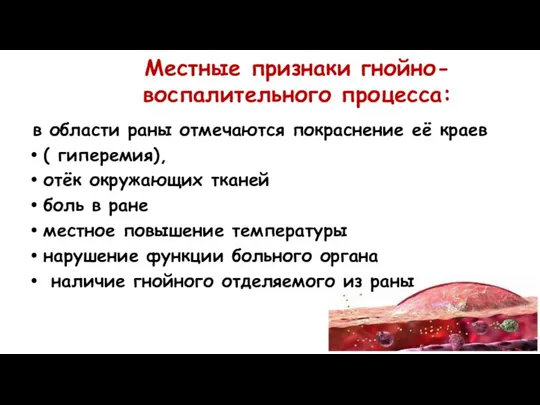 Местные признаки гнойно-воспалительного процесса: в области раны отмечаются покраснение её краев (