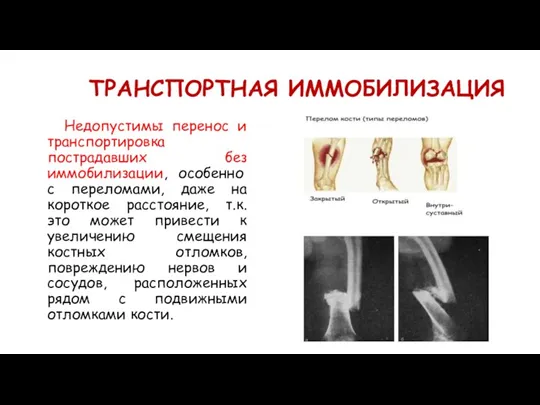 ТРАНСПОРТНАЯ ИММОБИЛИЗАЦИЯ Недопустимы перенос и транспортировка пострадавших без иммобилизации, особенно с переломами,