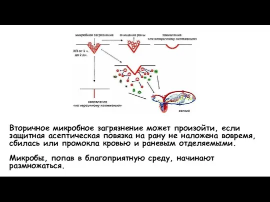 Вторичное микробное загрязнение может произойти, если защитная асептическая повязка на рану не