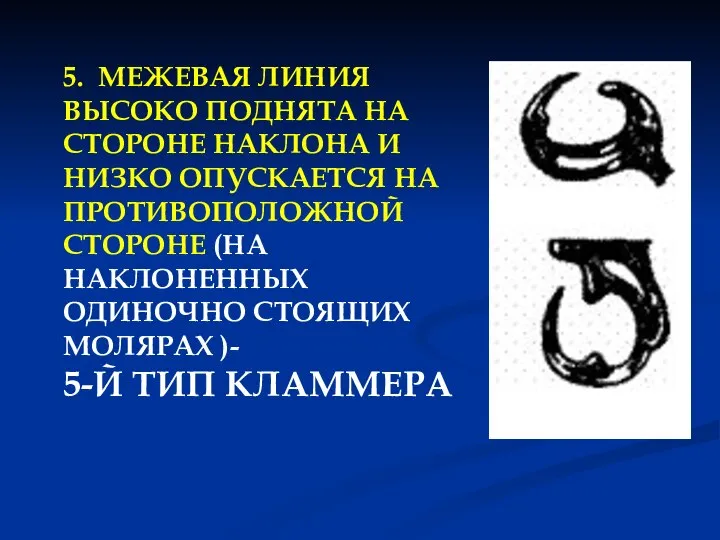 5. МЕЖЕВАЯ ЛИНИЯ ВЫСОКО ПОДНЯТА НА СТОРОНЕ НАКЛОНА И НИЗКО ОПУСКАЕТСЯ НА