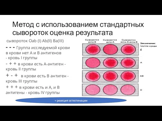 Метод с использованием стандартных сывороток оценка результата сывороток Оab (I) Аb(II) Вa(III)