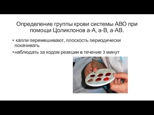 Определение группы крови системы АВО при помощи Цоликлонов а-А, а-В, а-АВ. капли