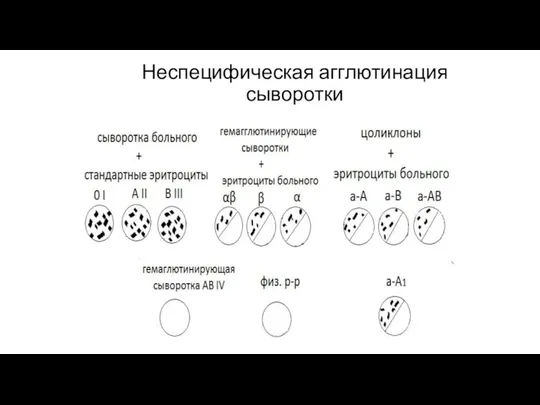 Неспецифическая агглютинация сыворотки