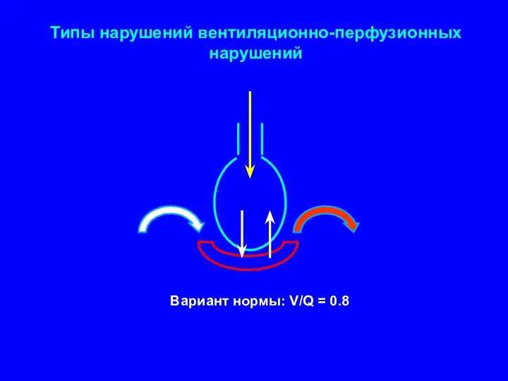 Типы нарушений вентиляционно-перфузионных нарушений Вариант нормы: V/Q = 0.8