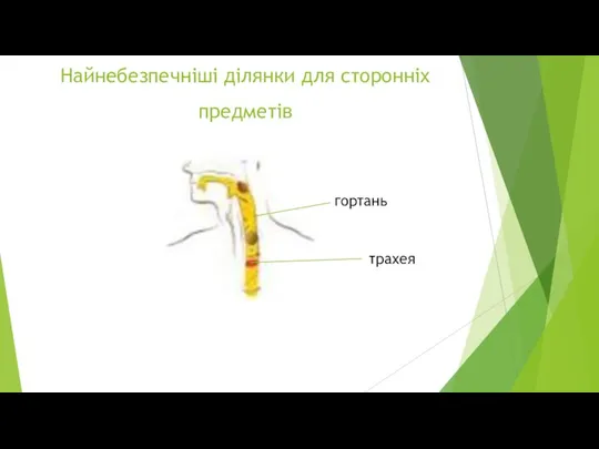 Найнебезпечніші ділянки для сторонніх предметів гортань трахея