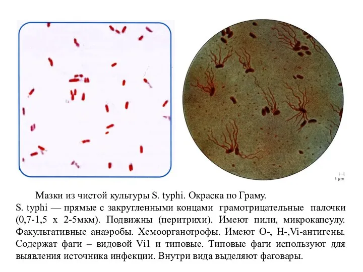 Мазки из чистой культуры S. typhi. Окраска по Граму. S. typhi —