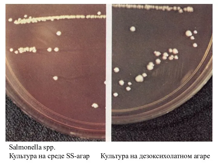 Salmonella spp. Культура на среде SS-агар Культура на дезоксихолатном агаре