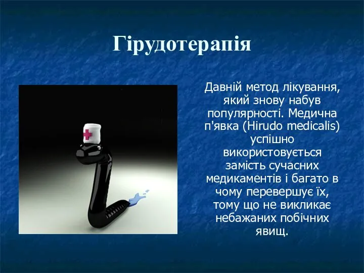 Гірудотерапія Давній метод лікування, який знову набув популярності. Медична п'явка (Hirudo medicalis)