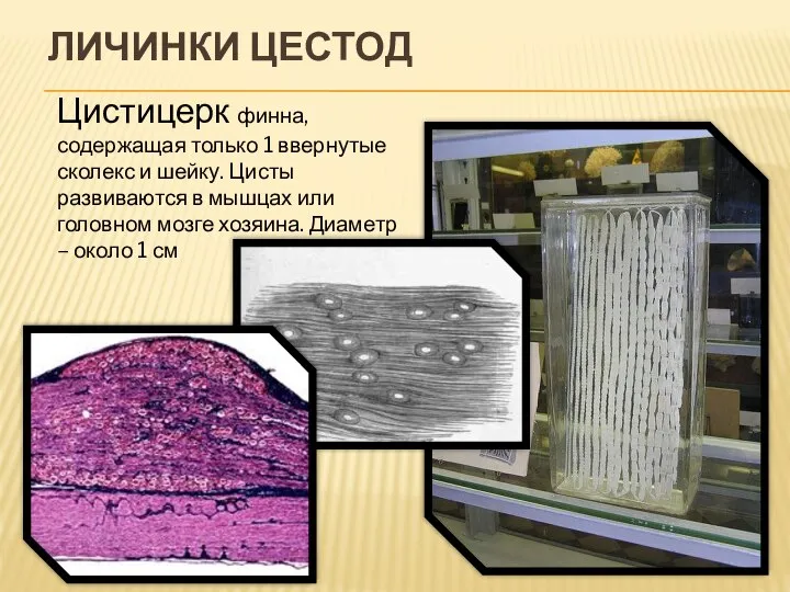 ЛИЧИНКИ ЦЕСТОД Цистицерк финна, содержащая только 1 ввернутые сколекс и шейку. Цисты