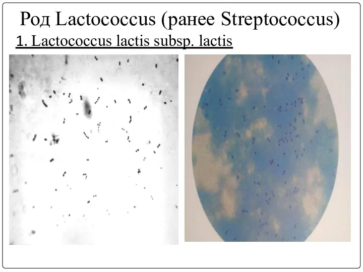 Род Lactococcus (ранее Streptococcus) 1. Lactococcus lасtis subsp. lасtis