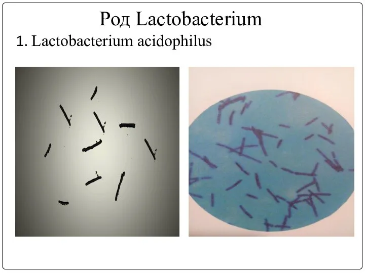 Род Lactobacterium 1. Lactobacterium acidophilus