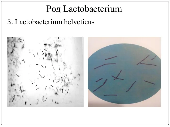 Род Lactobacterium 3. Lactobacterium helveticus