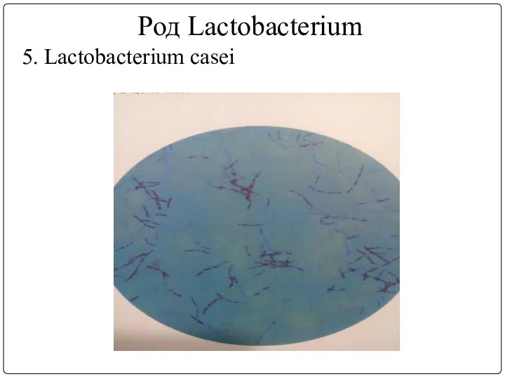 Род Lactobacterium 5. Lactobacterium casei