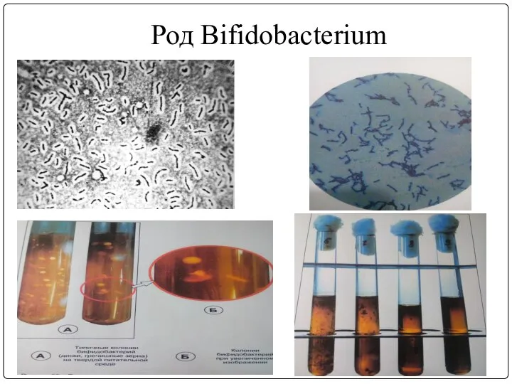 Род Bifidobacterium