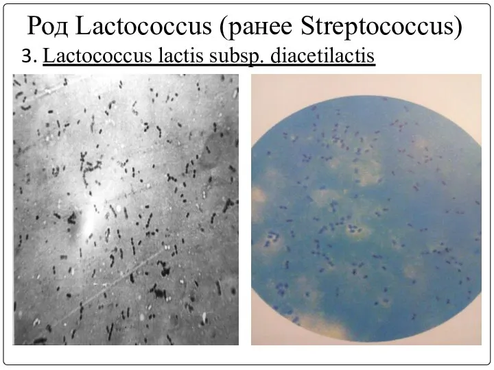 Род Lactococcus (ранее Streptococcus) 3. Lactococcus lасtis subsp. diacetilactis