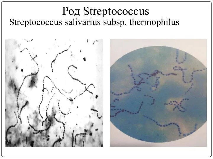 Род Streptococcus Streptococcus salivarius subsp. thermophilus