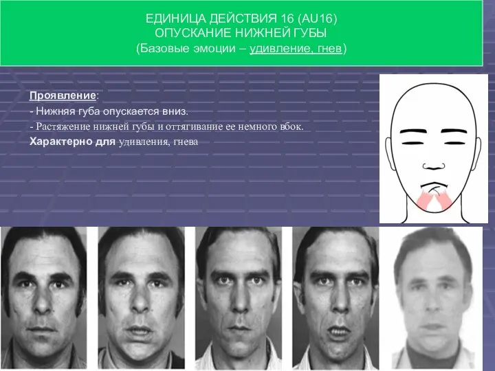 Проявление: - Нижняя губа опускается вниз. - Растяжение нижней губы и оттягивание