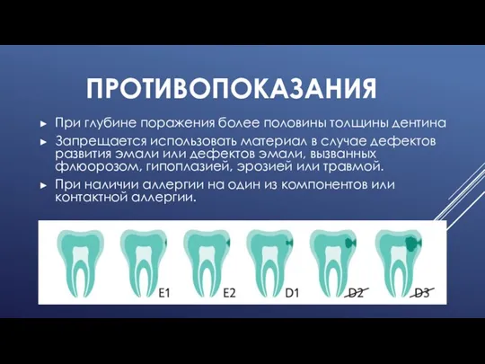 ПРОТИВОПОКАЗАНИЯ При глубине поражения более половины толщины дентина Запрещается использовать материал в