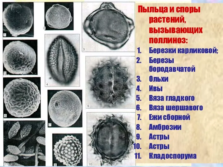 Пыльца и споры растений, вызывающих поллиноз: Березки карликовой; Березы бородавчатой Ольхи Ивы