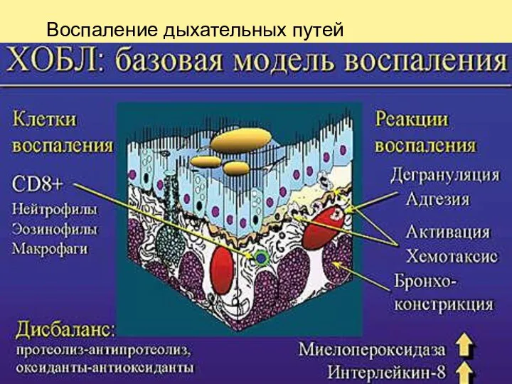 Воспаление дыхательных путей