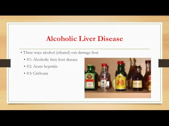 Alcoholic Liver Disease • Three ways alcohol (ethanol) can damage liver •